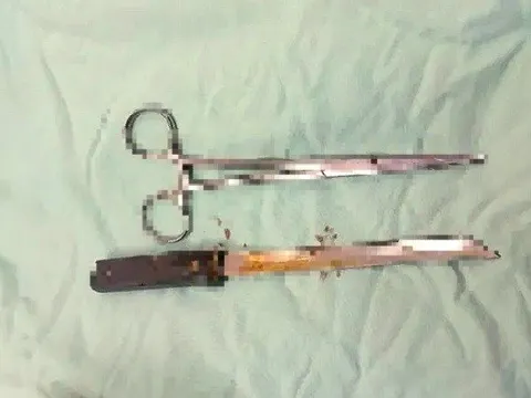 Cấp cứu nam thanh niên dùng dao tự đâm thủng bụng vì mâu thuẫn với vợ