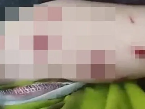 Bé trai 4 tuổi bị thương khi nhặt vật lạ ở sân nhà