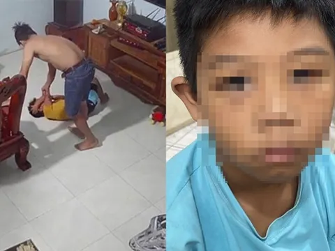 Vụ cha dượng đánh con riêng của vợ cũ: Người mẹ phản ứng thế nào khi con bị đánh?