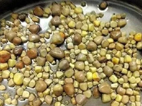 Nhiều người Việt mắc sỏi thận do thói quen thường ngày mà không biết