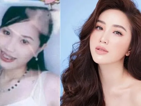 Đã niềng răng thì phải "ngoạn mục" như sao nữ này, nhan sắc thăng hạng cực đỉnh, U40 vẫn khiến nhiều người trầm trồ