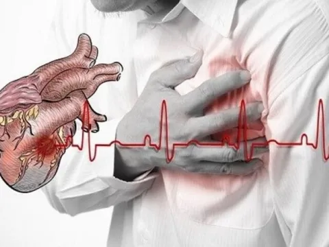 Liên tiếp cấp cứu nhiều ca vỡ tim: Bác sĩ đưa ra khuyến cáo