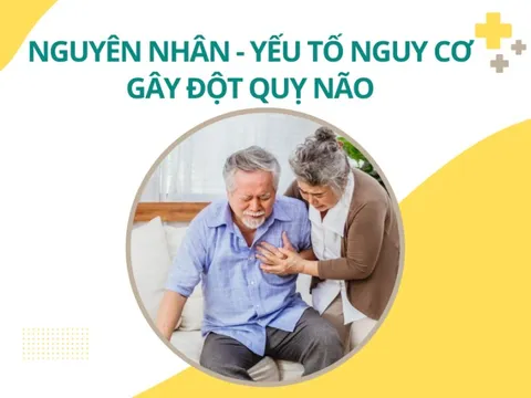 Nguyên nhân gây đột quỵ não và cách phòng ngừa hiệu quả