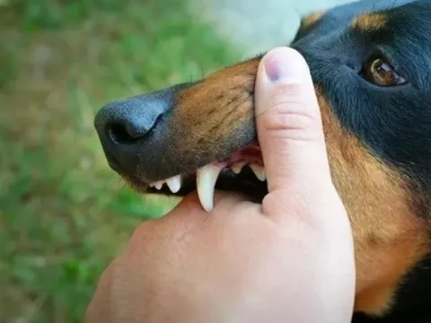 Hà Nội: Đang quét ngõ, cụ bà bị chó hàng xóm tấn công phải khâu 70 mũi