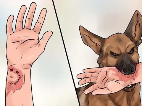 Bình Thuận ghi nhận một ca tử vong nghi do chó dại cắn