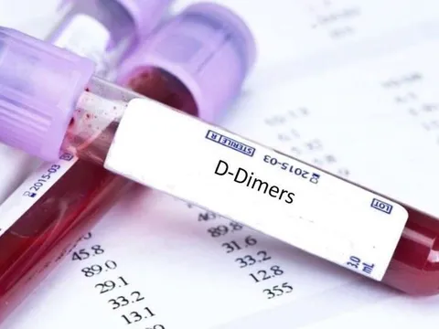 Bộ Y tế chính thức lên tiếng về thông tin "xét nghiệm đông máu sau tiêm vắc xin AstraZeneca"