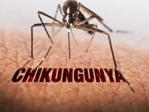 Bộ Y tế bác thông tin Việt Nam có ca mắc bệnh Chikungunya